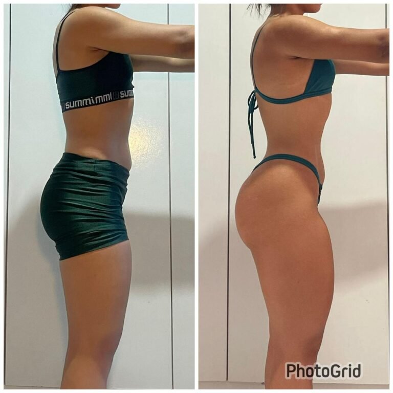 antes e depois 10