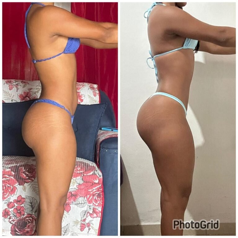 antes e depois 11