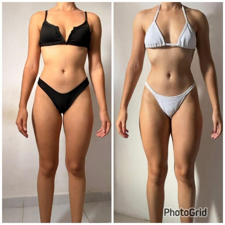 antes e depois 4