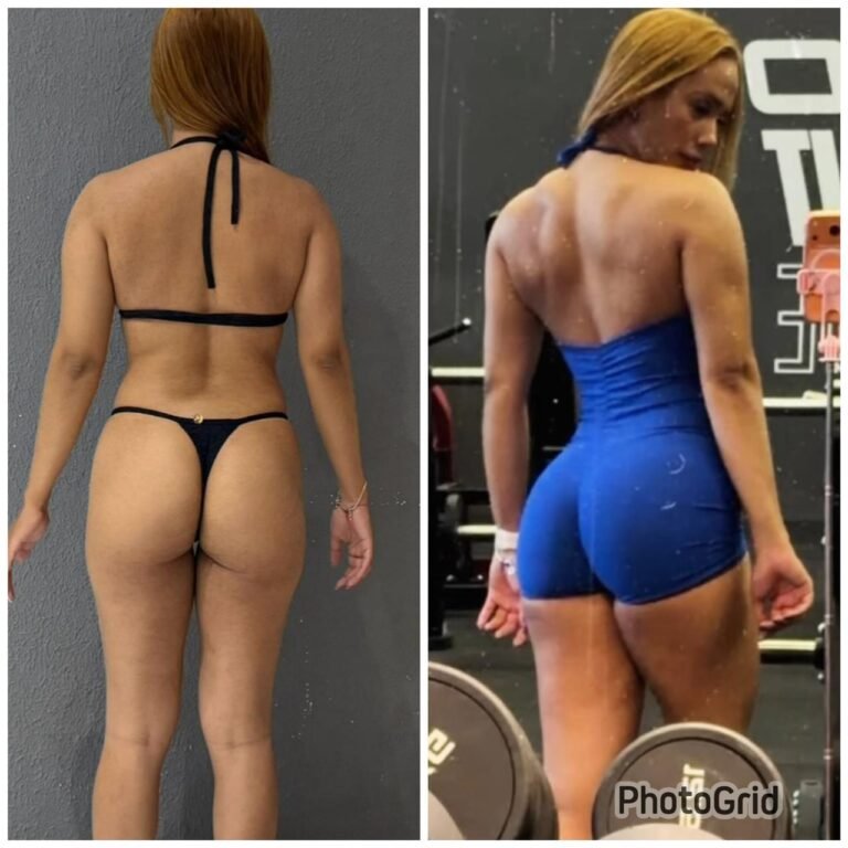 antes e depois 6