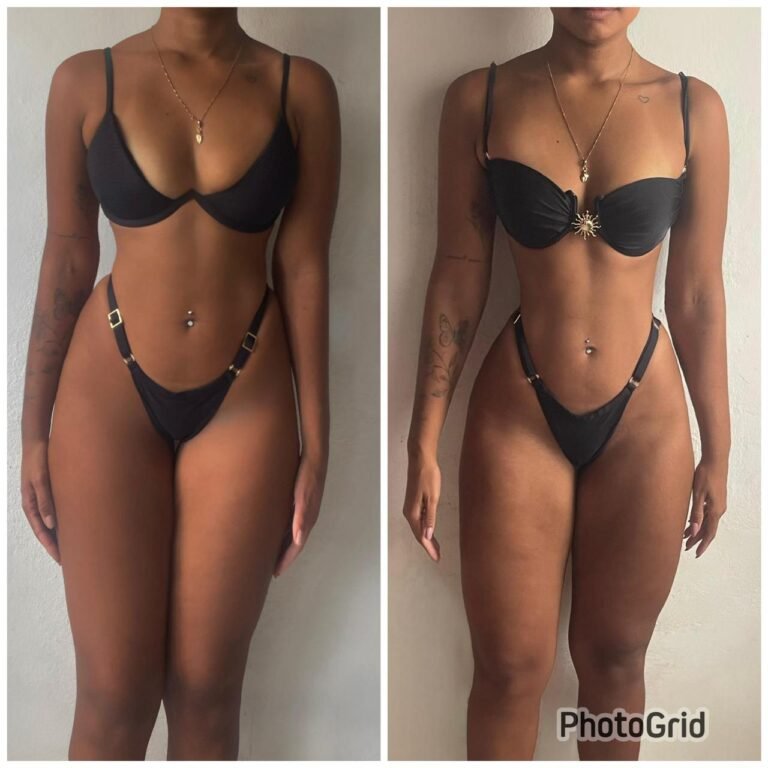 antes e depois 7