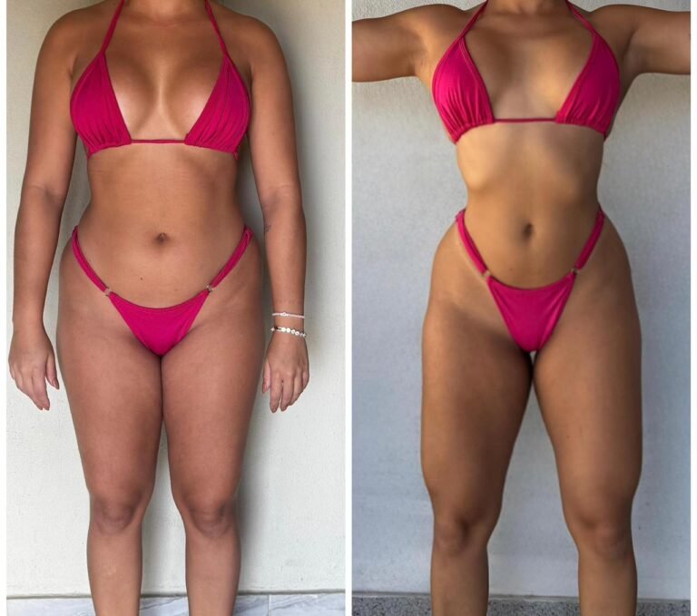 antes e depois 8
